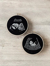 Load image into Gallery viewer, Custom Ultrasound Embroidery Hoop